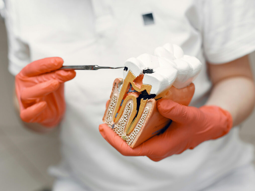 Carie e Mal di Denti a Bellaria