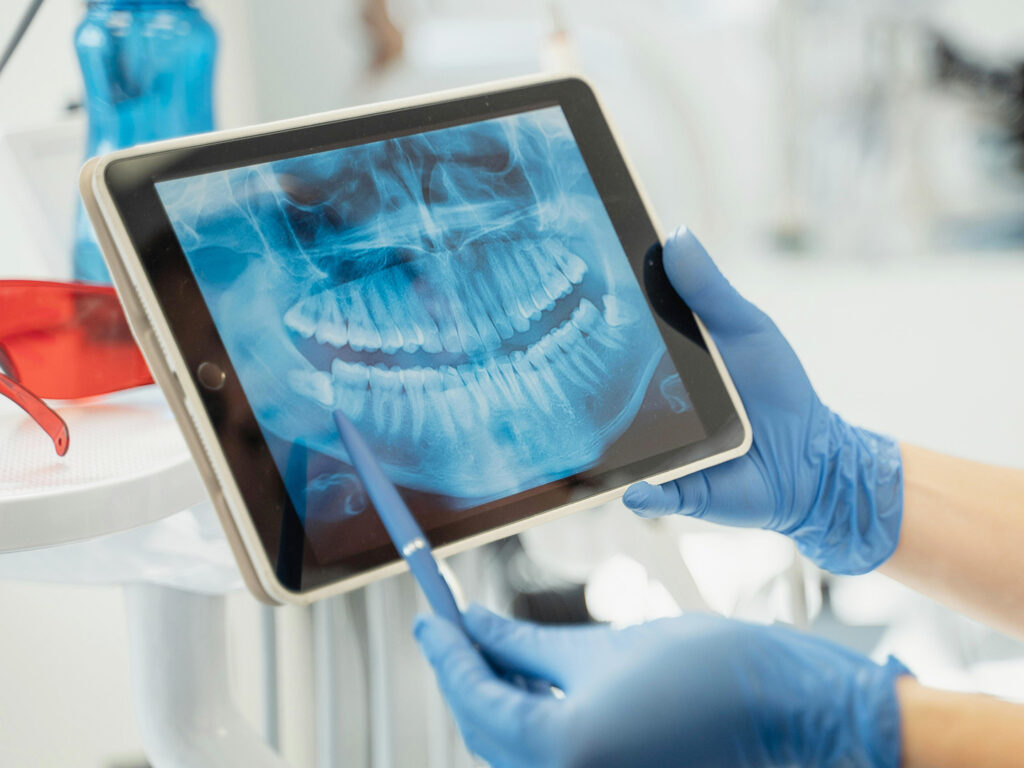 Denti del Giudizio a Bellaria