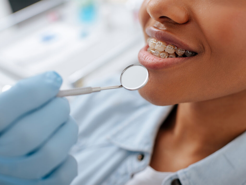 Ortodonzia a Bellaria