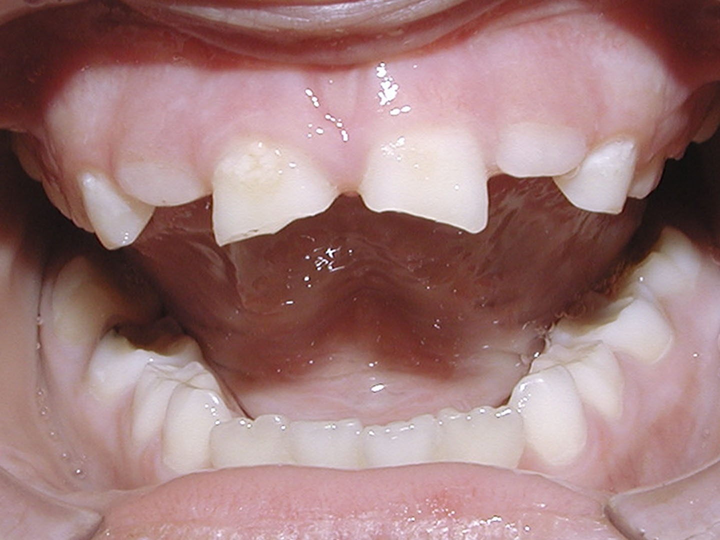 Dott.ssa Emanuela Muratore | Estetica Dentale a Bellaria: prima dell’intervento – Caso 1